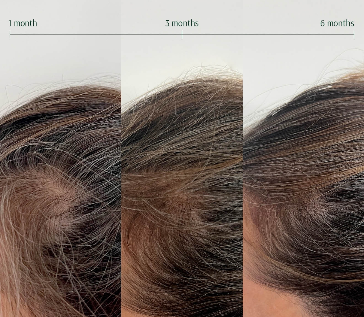 Onion deals for hair